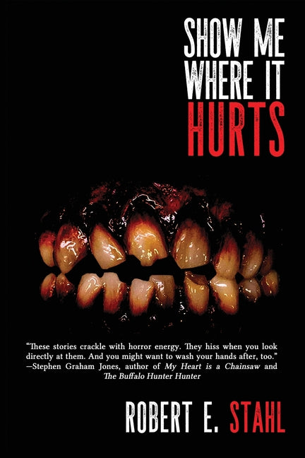 Show Me Where It Hurts